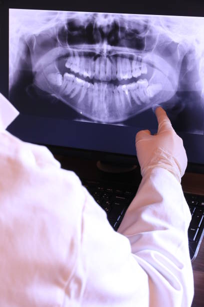 Best Emergency Root Canal Treatment in Frisco, TX